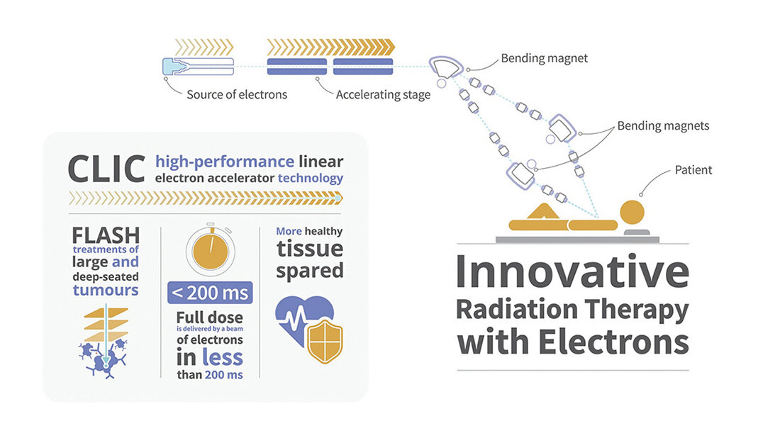 Weltneuheit in der Krebs-Strahlentherapie? Abbildung zur Innovative Radiation Therapy with Electrons