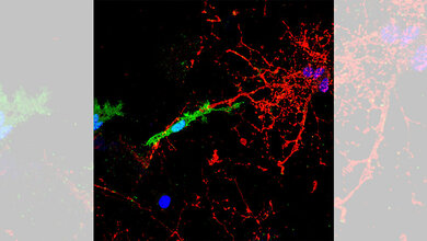Mikrogliale_Zelle_gruen_kontaktiert_und_attackiert_myelinisierte_Axonfortsaetze_rot_Foto_HHU_Joel_Gruchot_Patrick_Kuery.jpg Mikrogliale Zelle (grün) kontaktiert und attackiert myelinisierte Axonfortsätze (rot)