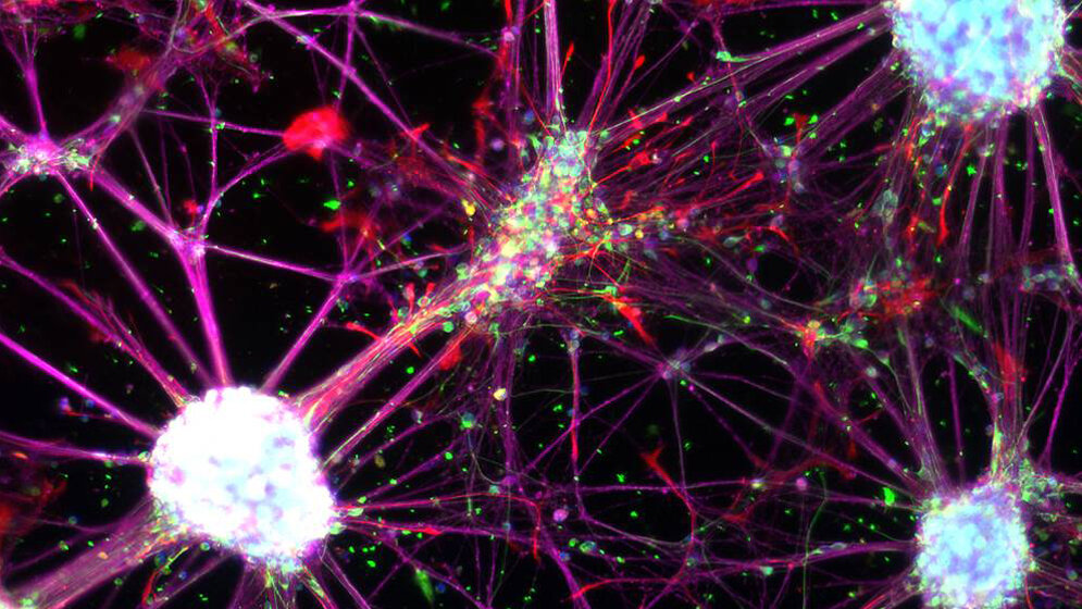 Netzwerk aus neuralen Stammzellen