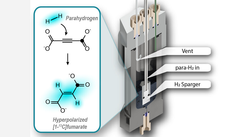 Hyperpolarisation von Fumarat