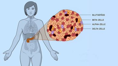 Grafische Darstellung einer Person auf blauem Hintergrund mit der Bauchspeicheldrüse im Fokus und Beschriftung der einzelnen Alpha-, Beta- und Delta-Zellen