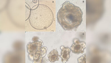 Vier mikroskopische Aufnahmen spezifischer Organoidkulturen in Brauntönen
