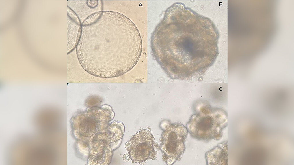 Organoid_Darmkrebs.jpg Vier mikroskopische Aufnahmen spezifischer Organoidkulturen in Brauntönen