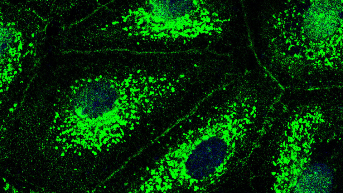 Fluoreszenzmikroskopisches Bild 