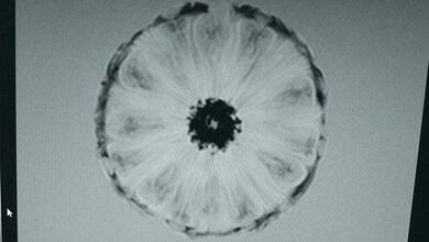 Erfolgreicher Aktionstag Radiologie