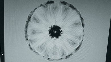 Erfolgreicher Aktionstag Radiologie