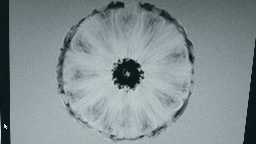 Veranstaltungsberichte Erfolgreicher Aktionstag Radiologie