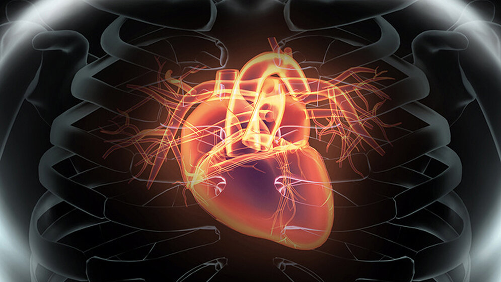 Diagnose: Brugada-Syndrom