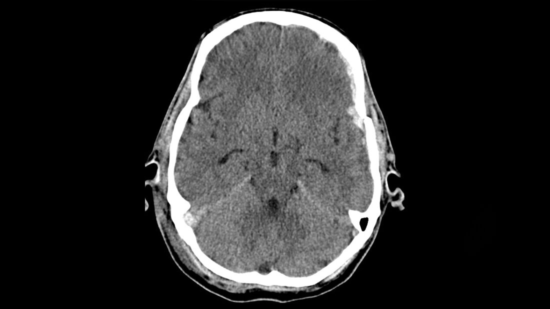 Schwerpunktthema Titelbild zum Fachbeitrag zum Schädel-Hirn-Trauma in der Radiologischen Diagnostik