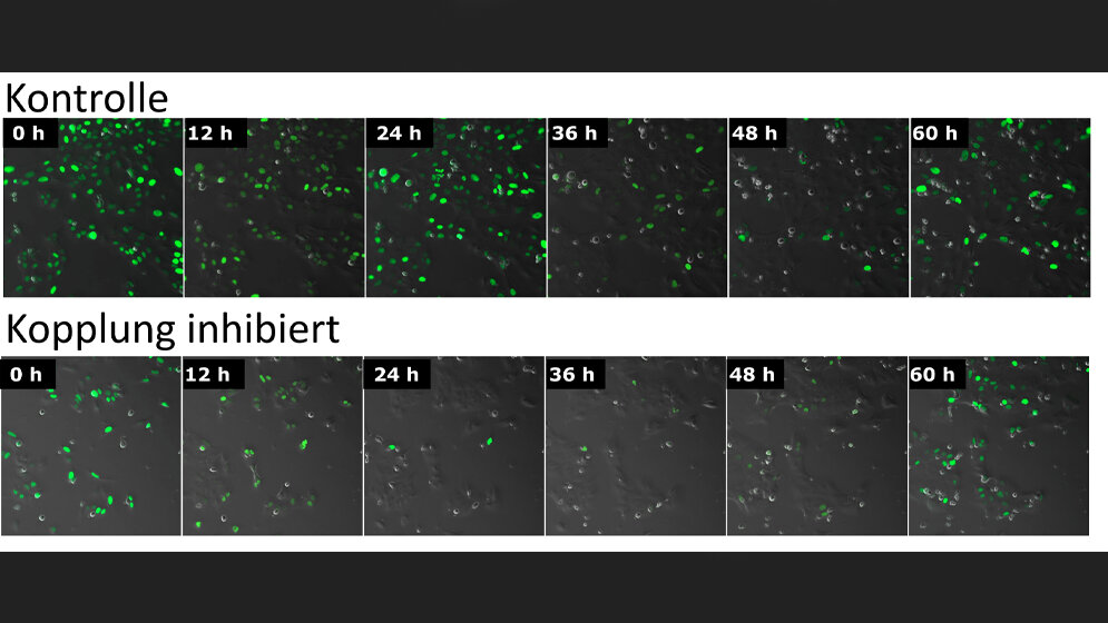 Mikroskopische_Aufnahmen_menschlicher_Knochenkrebszellen_Charite_Adrian_E_Granada.jpg Mikroskopische Aufnahmen menschlicher Knochenkrebszellen