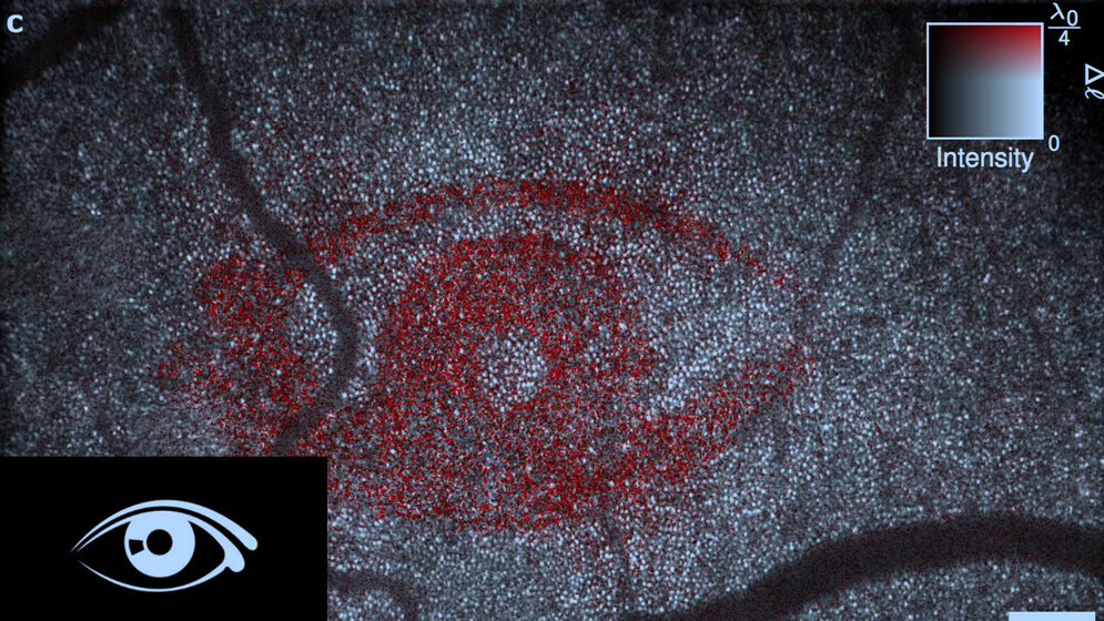 Photorezeptorennewsimage281503.jpg Photorezeptoren