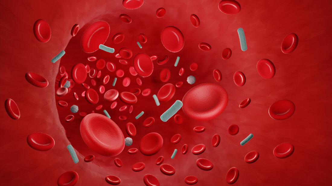 Blutstrominfektion_Adobe.jpg Prognosemodell bei Blutstrominfektionen