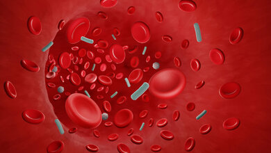 Prognosemodell bei Blutstrominfektionen 