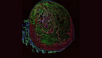 Thrombus_einer_Maus.jpg Ein Thrombus aus der Vene einer Maus