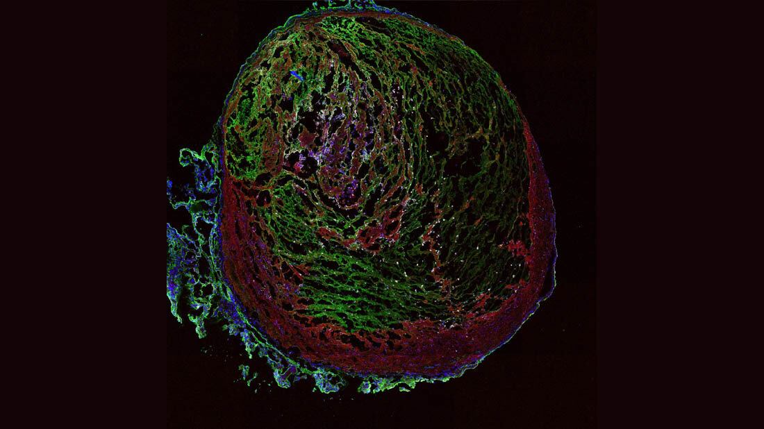 Thrombus_einer_Maus.jpg Ein Thrombus aus der Vene einer Maus