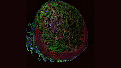 Thrombus_einer_Maus.jpg Ein Thrombus aus der Vene einer Maus