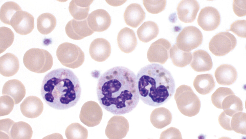 Zytologie Granulopoese (Teil 3)