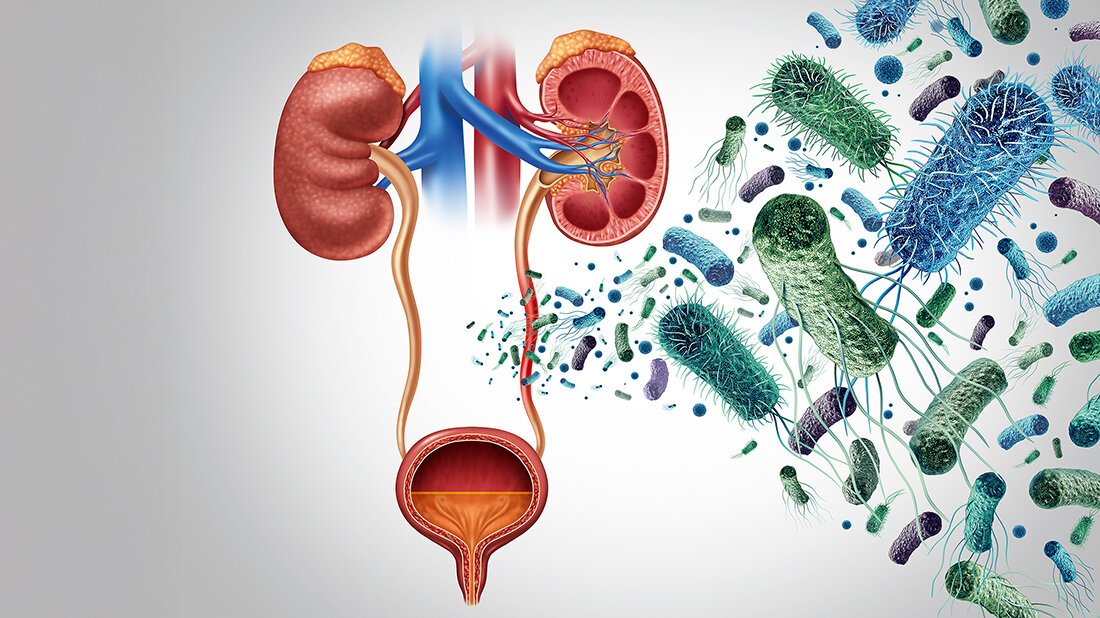 Schematische Darstellung des menschlichen Harntrakts mit Nieren, Harnleitern und Blase; rechts daneben zahlreiche vergrößert dargestellte Bakterien als Symbol für eine Harnwegsinfektion