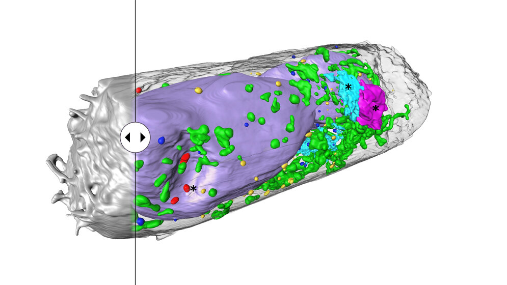 Zelle des menschlichen Lungenepithels