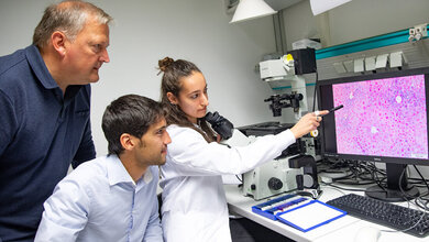 Haemochromatose.jpg (von links): Professor Dr. Michael Ott, Dr. Simon Krooss und Erstautorin Dr. Alice Rovai