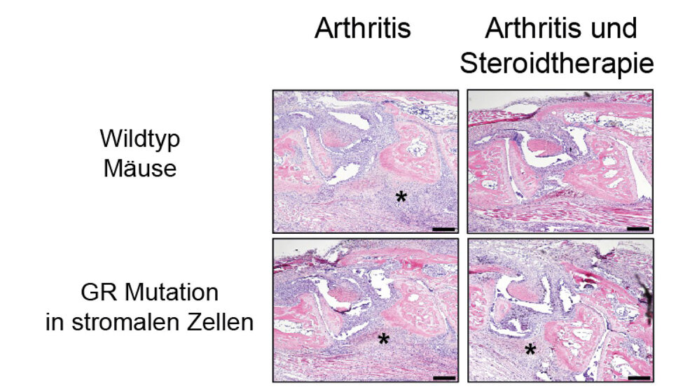 Histologische_Untersuchungen_von_arthritischen_Wildtyp_Maeusen_Abbildung_Institut_fuer_Molekulare_Endokrinologie_der_Tiere.jpg Histologische_Untersuchungen_von_arthritischen_Wildtyp_Maeusen_Abbildung_Institut_fuer_Molekulare_Endokrinologie_der_Tiere.jpg