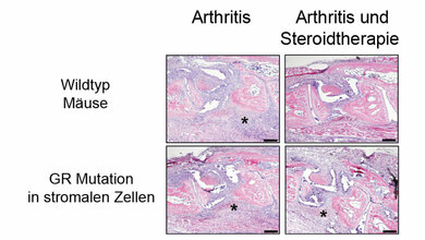 Histologische_Untersuchungen_von_arthritischen_Wildtyp_Maeusen_Abbildung_Institut_fuer_Molekulare_Endokrinologie_der_Tiere.jpg