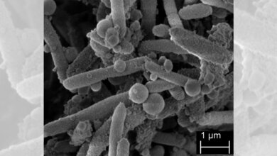 Stenotrophomonas maltophilia 