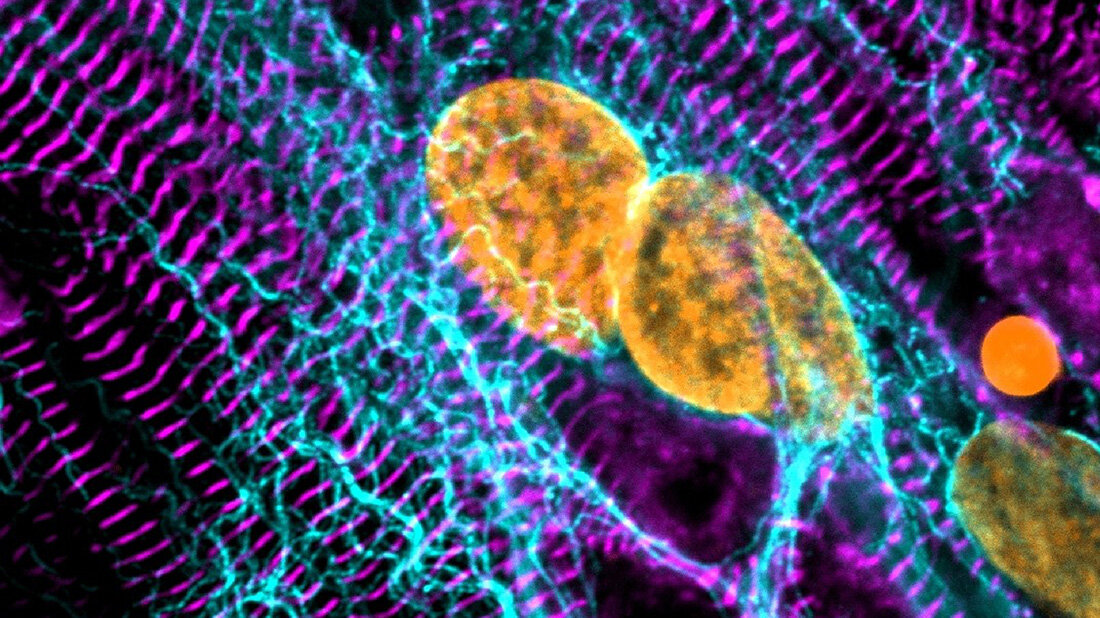 Stammzell-Kardiomyozyten