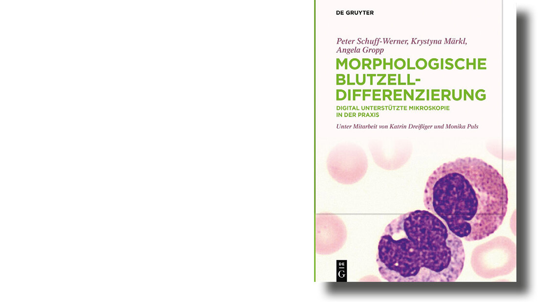 Morphologische Blutzelldifferenzierung – digital unterstützt Abbildung des rezensierten Buchs