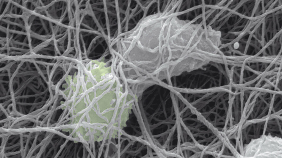 B-Zelle bindet T-Zelle