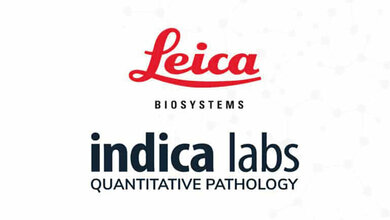 Leica Biosystems: Partnerschaft mit Indica Labs
