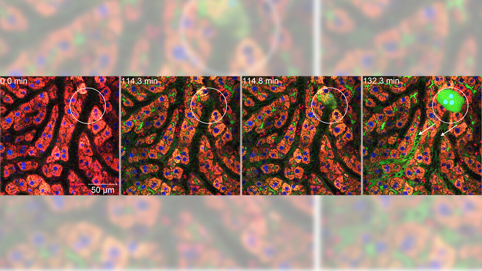 Leberzelle.jpg Leberzelle.jpg