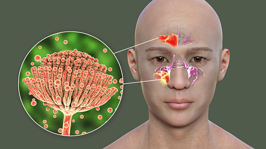 Grafik zur Allergieauslösung