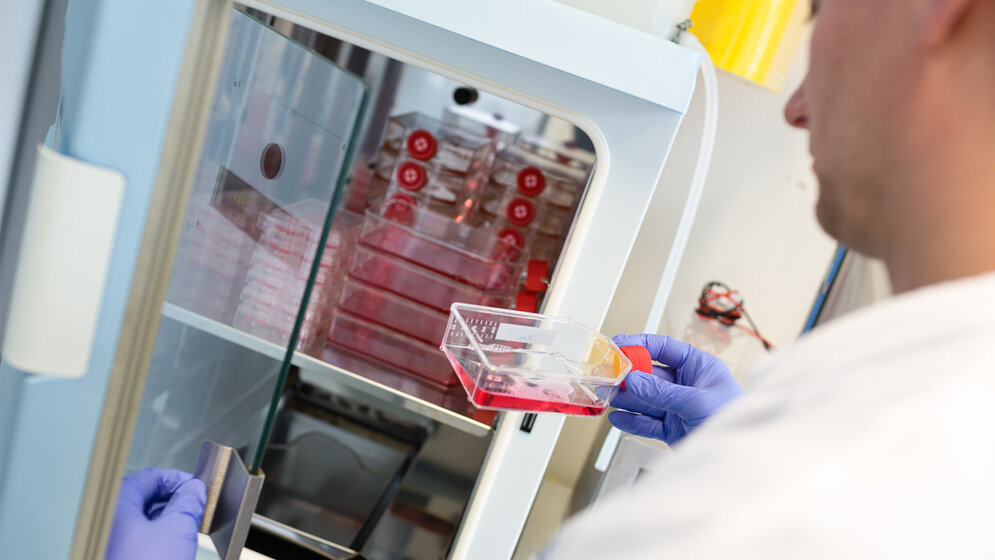 Untersuchung von Tumorzellen im Labor