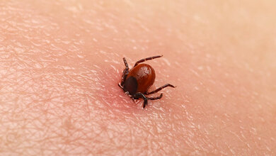 Zecke sticht einen Menschen.