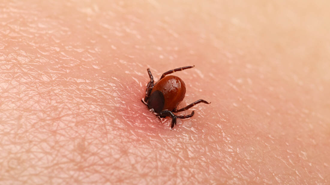 Zecke sticht einen Menschen.
