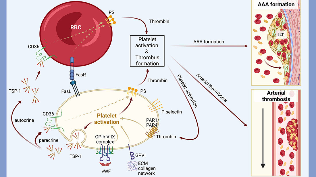 Thrombose_Aortenaneurysma.jpg Schematische Darstellung des gemeinsamen Mechanismus der Thrombose und des Aortenaneurysmas