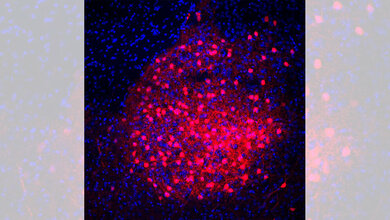 CRH Neuronen (rot) im Mandelkern