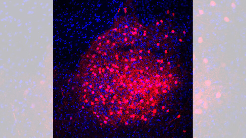 CRH Neuronen (rot) im Mandelkern