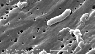 Vibrio cholerae Bakterium