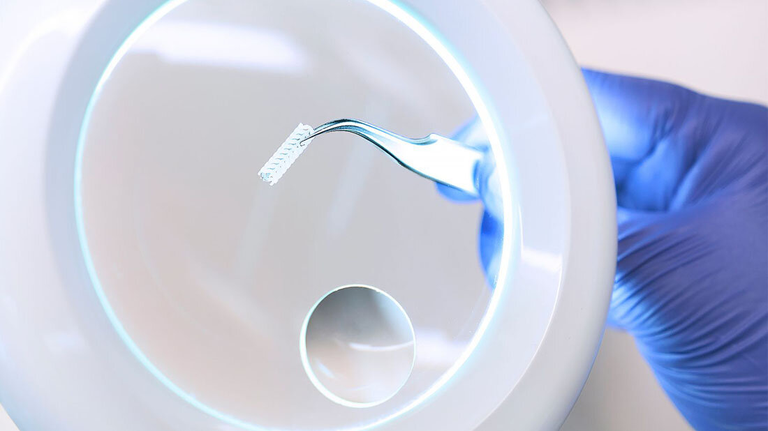 Ein innovativer Stent unter der Lupe.