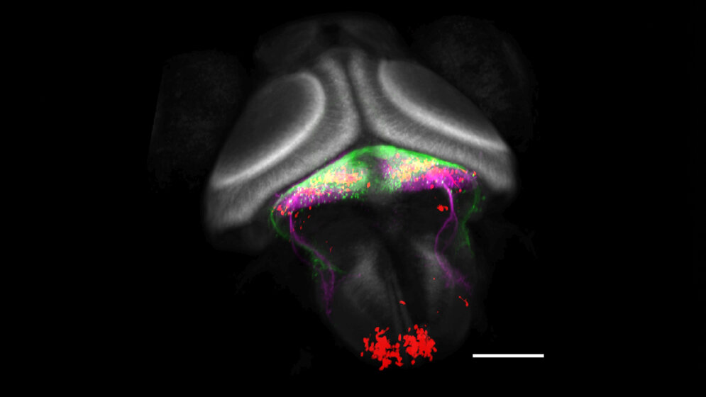 Aufbau des Kleinhirns 