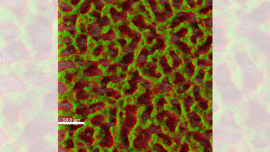 Krankenhauskeim_Pseudomonas_aeruginosa_TWINCORE_Janne_Thoeming.jpg Der Krankenhauskeim Pseudomonas aeruginosa