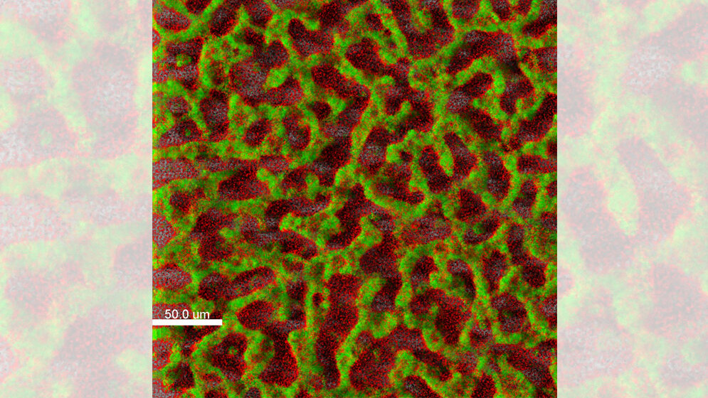 Der Krankenhauskeim Pseudomonas aeruginosa