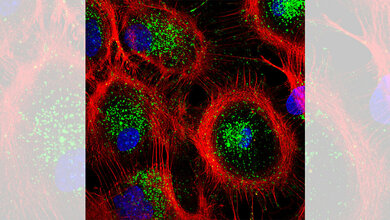 Aufnahme von Astrozyten aus der Maus