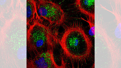 Aufnahme_von_Astrozyten_aus_der_Maus_Tania_Lopez_Hernandez_FMP.jpg Aufnahme von Astrozyten aus der Maus