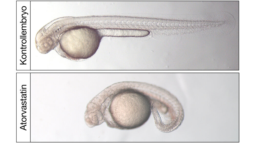 Lichtmikroskopische Aufnahme von zwei Tage alten Zebrafischembryonen.