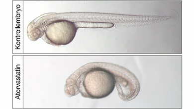 Lichtmikroskopische Aufnahme von zwei Tage alten Zebrafischembryonen.