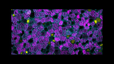 Menschliche Atemwegszellen im Labor gezüchte