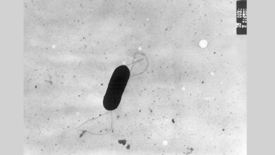 Listeria monocytogenes 
